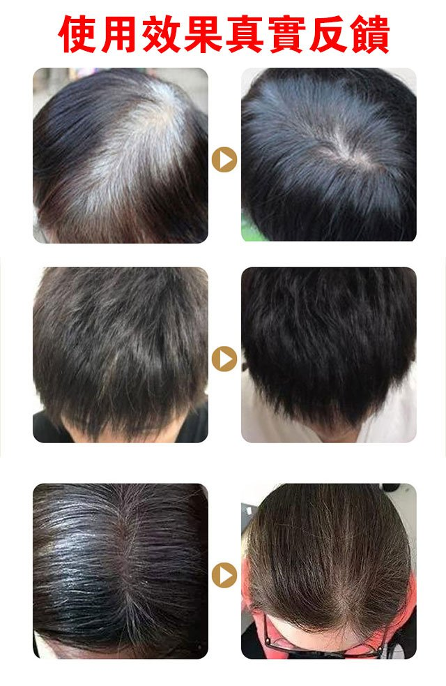 1688639634878820.png a9849f1687d05e06e0b006ead9fe347.png