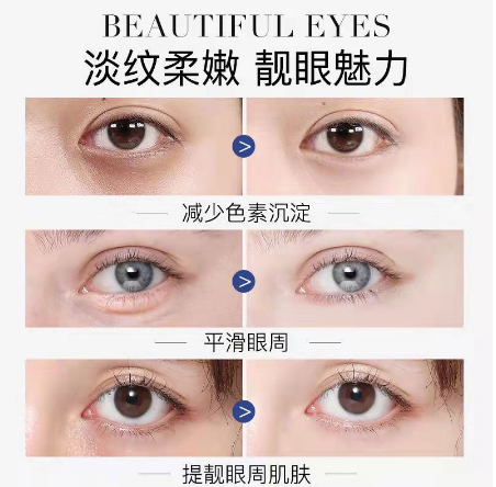 台灣熱銷【眼部救星棒】熱熔霜 急救眼部肌膚問題!KO眼袋·眼紋·眼腫·黑眼圈,連笑容紋都可以一拖即平 台灣熱銷【眼部救星棒】熱熔霜 急救眼部肌膚問題!KO眼袋·眼紋·眼腫·黑眼圈,連笑容紋都可以一拖即平