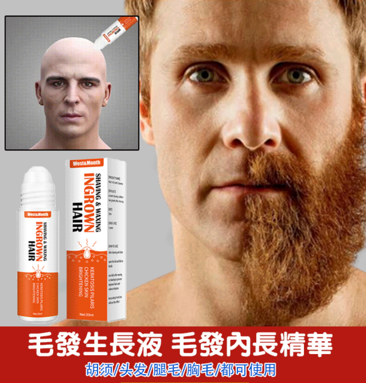 買二送一!West&Month毛髮逆生長精華 買二送一!West&Month毛髮逆生長精華