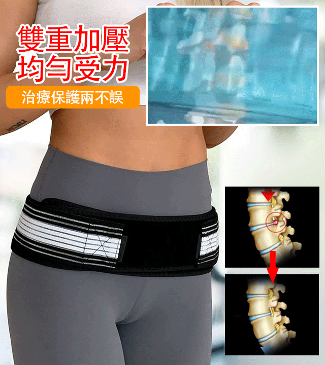 緩解腰痛坐骨神經痛腰帶。 坐骨神經痛和下背部疼痛的終極緩解，減輕骨盆關節的負荷